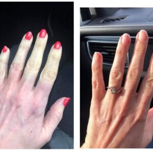 Freedom for Raynauds pain.